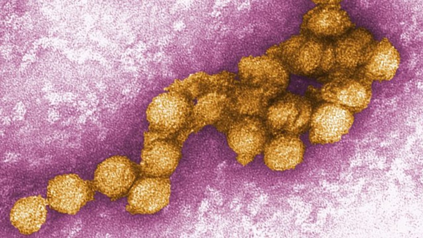 Das Foto zeigt eine elektronenmikroskopische Aufnahme des West-Nil-Virus.