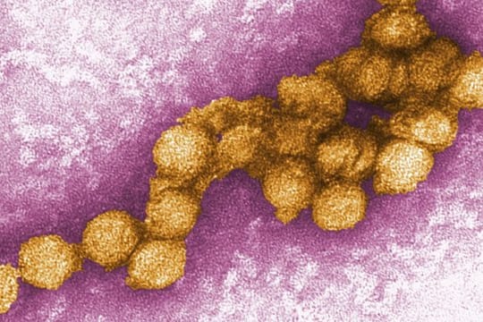Das Foto zeigt eine elektronenmikroskopische Aufnahme des West-Nil-Virus.