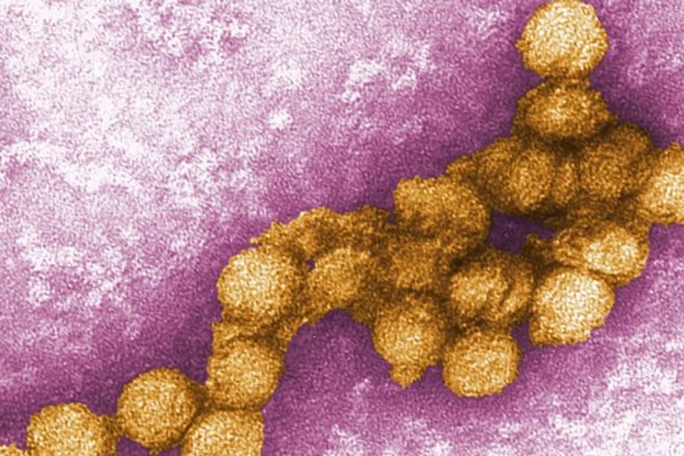 Dieses Jahr hat das West-Nil-Fieber besonders viele Menschen in Europa krank gemacht oder getötet.