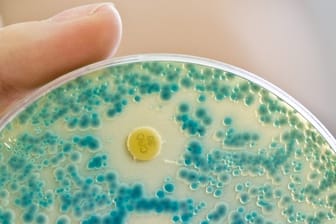In 39 Prozent der betrachteten Fälle seien die Patienten mit einem Keim infiziert, gegen den auch Reserve-Antibiotika nichts mehr ausrichten können.
