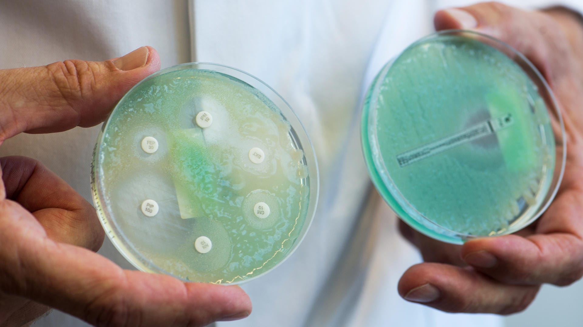 Petrischalen: Die Keime weisen Mehrfachresistenzen gegenüber Antibiotika auf. Petrischalen: Die Keime weisen Mehrfachresistenzen gegenüber Antibiotika auf.