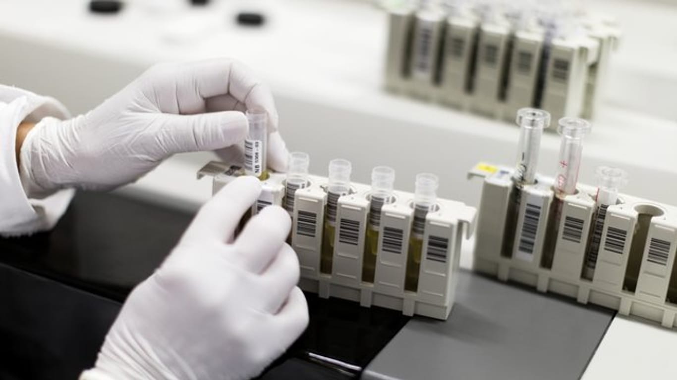 HIV-Test: Ein Analysegerät wird in einem Labor mit Patientenproben beladen.