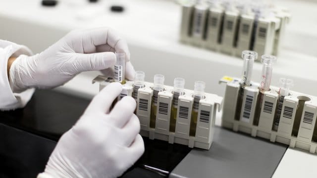 HIV-Test: Ein Analysegerät wird in einem Labor mit Patientenproben beladen. HIV-Test: Ein Analysegerät wird in einem Labor mit Patientenproben beladen.