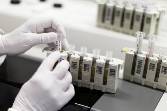 HIV-Test: Ein Analysegerät wird in einem Labor mit Patientenproben beladen.