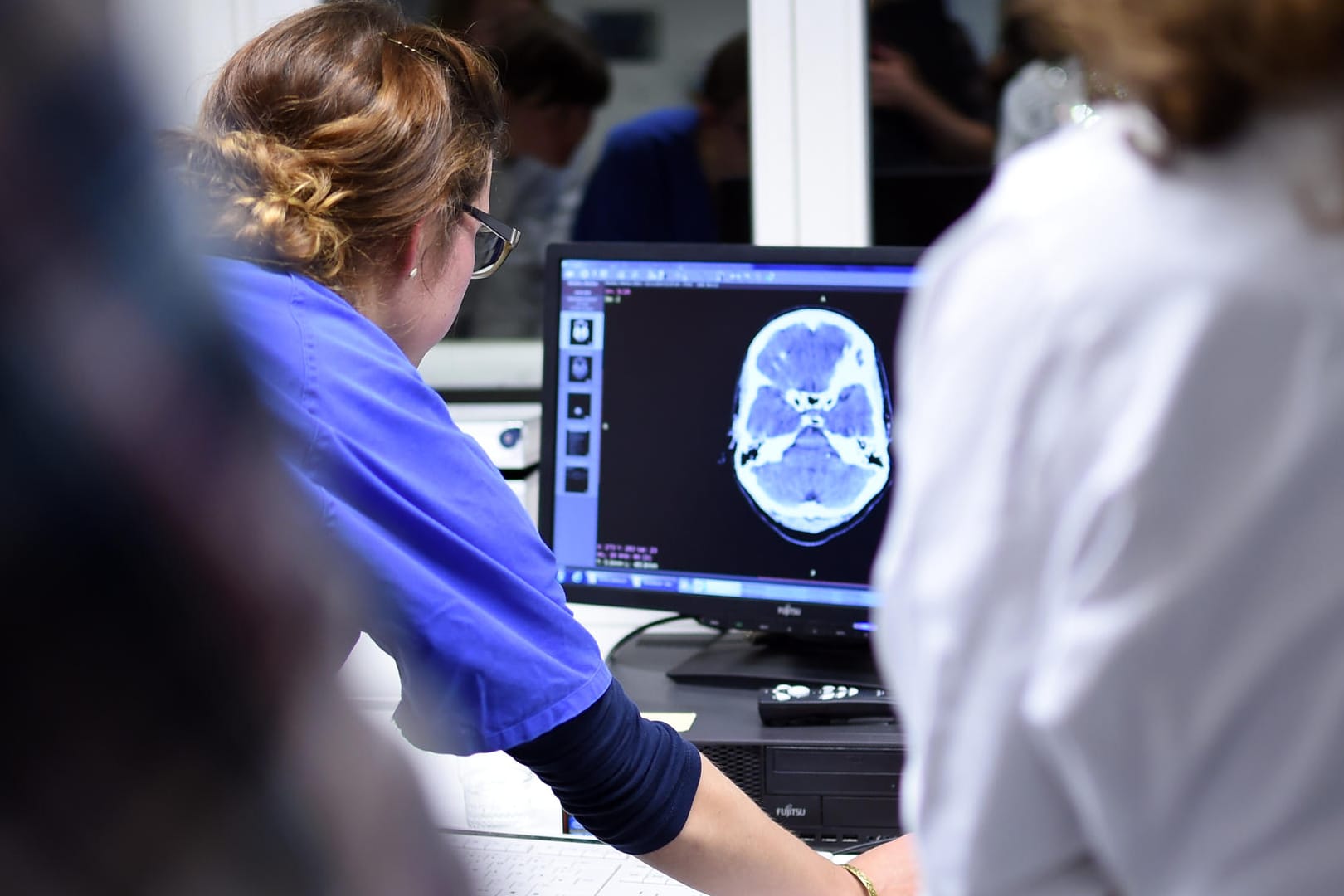Eine Medizinstudentin sieht sich eine Computertomographie an: Mit Hilfe von Künstlicher Intelligenz könnten Ärzte Tausende Datensätze in wenigen Minuten miteinander vergleichen.
