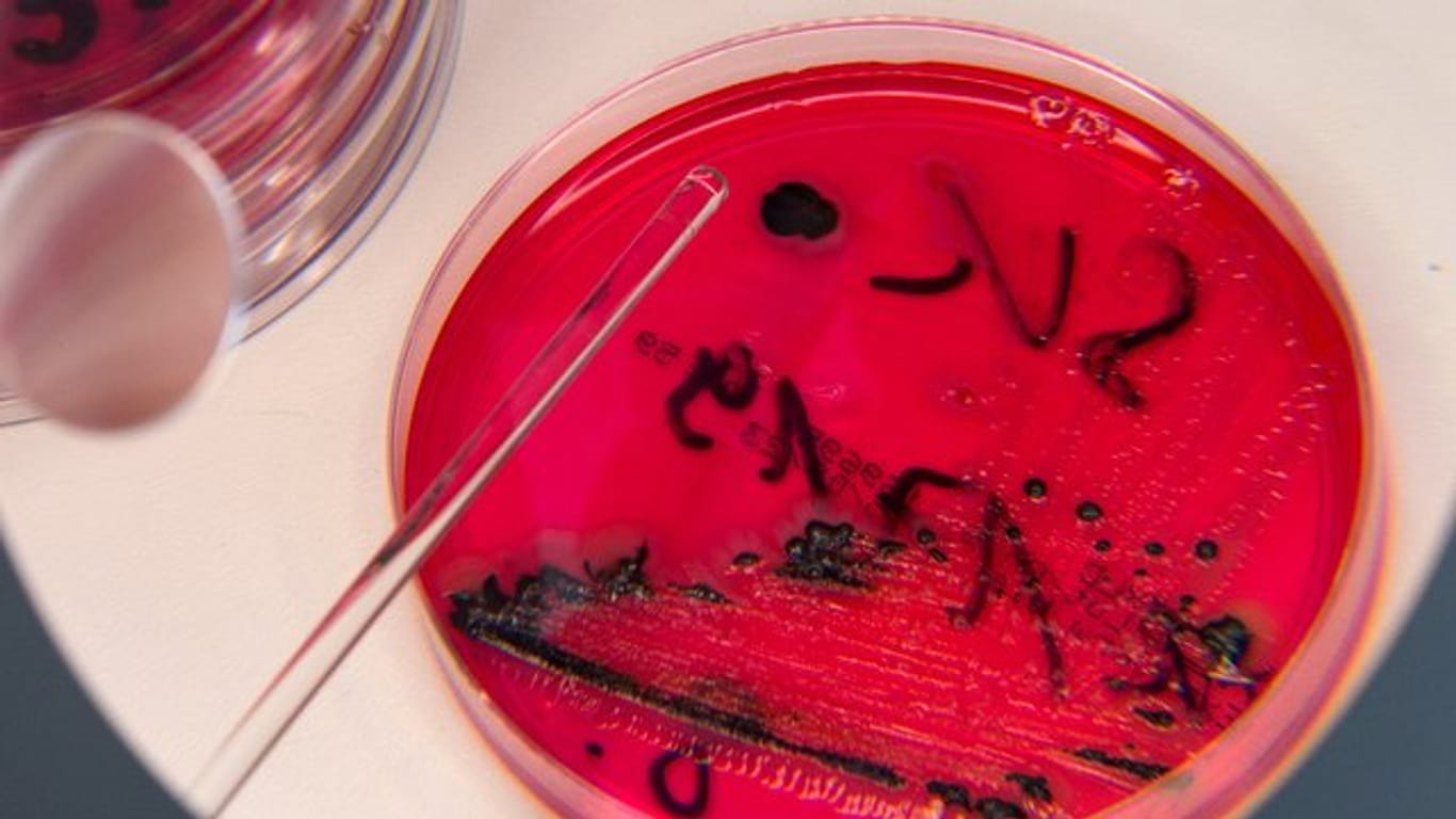 Salmonellen in einer Petrischale: Ein Gewürz wird derzeit zurückgerufen, weil es mit Salmonellen belastet sein könnte.