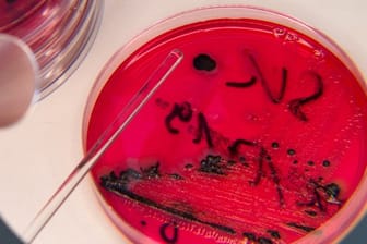 Salmonellen in einer Petrischale: Ein Gewürz wird derzeit zurückgerufen, weil es mit Salmonellen belastet sein könnte.
