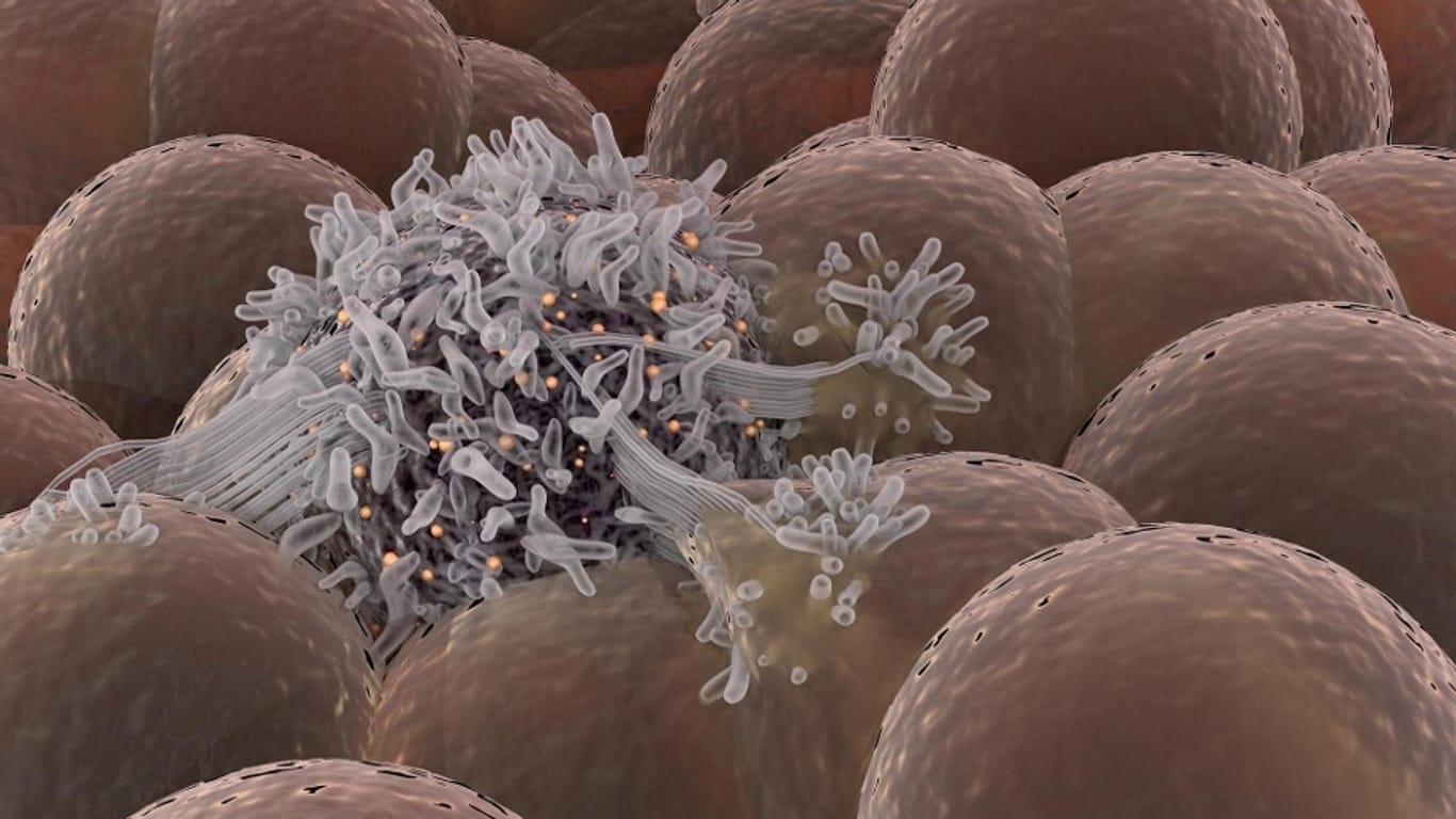 3-D-Illustration einer Ausbreitung von Krebszellen unter gesunden Stammzellen.