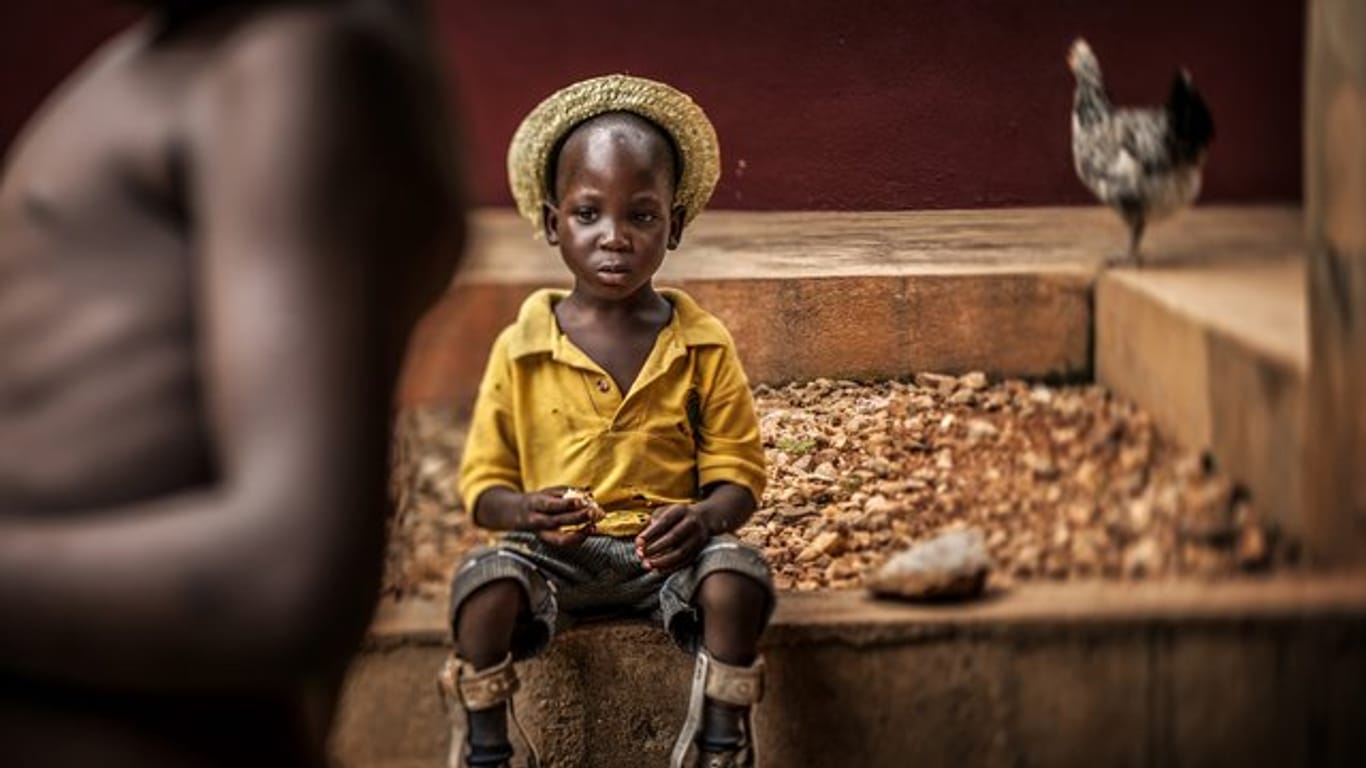 Das "Unicef-Foto des Jahres 2018" zeigt einen Jungen mit Beinprothesen in einem Waisenhaus in Bombouaka, Togo.
