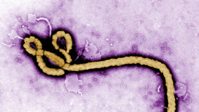 Die Aufnahme eines Elektronenmikroskops zeigt ein einzelnes Viruspartikel des Ebola-Virus. Die Aufnahme eines Elektronenmikroskops zeigt ein einzelnes Viruspartikel des Ebola-Virus.