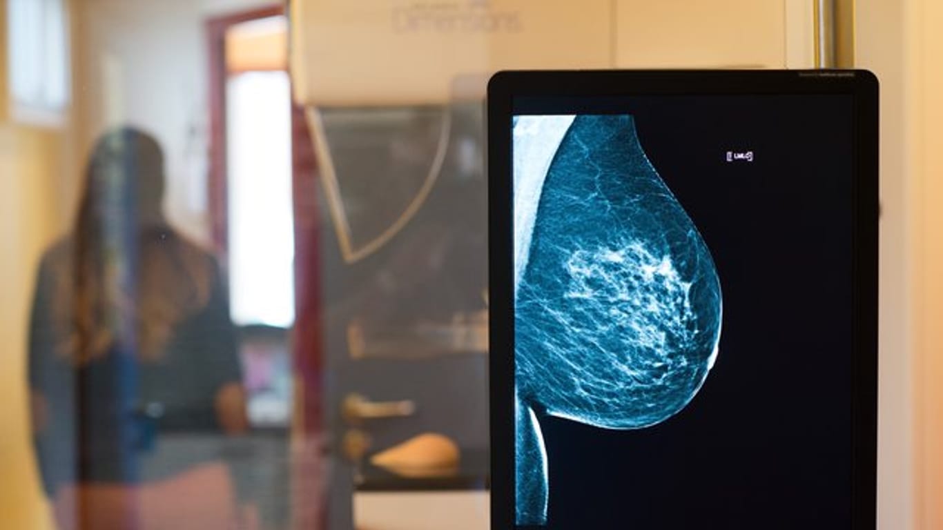 Röntgenbild eines Mammographie-Screening-Programms: Bei Frauen war Brustkrebs im Jahr 2016 die häufigste Krebserkrankung mit Todesfolge.
