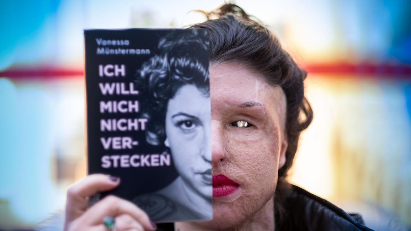 Vanessa Münstermann stellt ihr Buch vor: Sie wurde vor 2016 Opfer eines Säureanschlags.