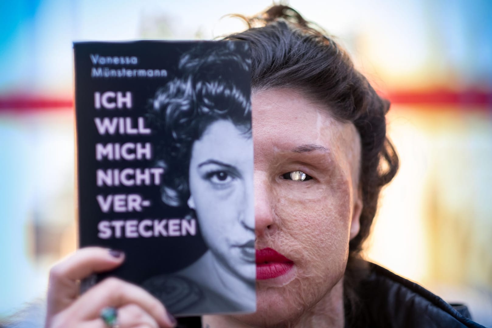 Vanessa Münstermann stellt ihr Buch vor: Sie wurde vor 2016 Opfer eines Säureanschlags.