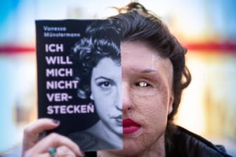 Vanessa Münstermann stellt ihr Buch vor: Sie wurde vor 2016 Opfer eines Säureanschlags.