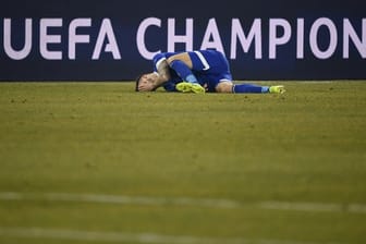 Schalkes Guido Burgstaller hat sich im Spiel gegen Manchester City verletzt.