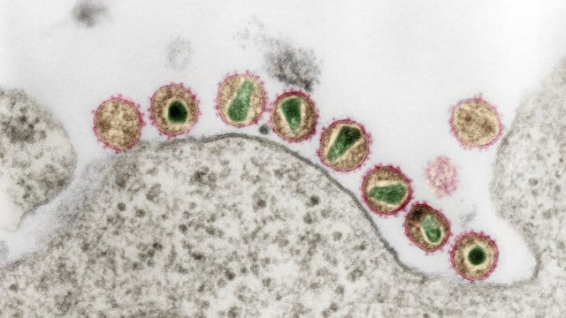 HIV-1 (Retroviren) in einer kolorierten Ultradünnschnitt-Aufnahme eines Transmissions-Elektronenmikroskops.