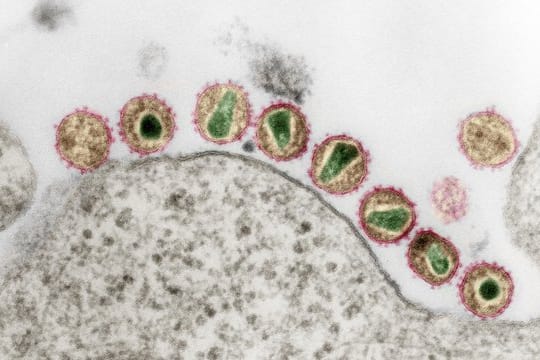 HIV-1 (Retroviren) in einer kolorierten Ultradünnschnitt-Aufnahme eines Transmissions-Elektronenmikroskops.