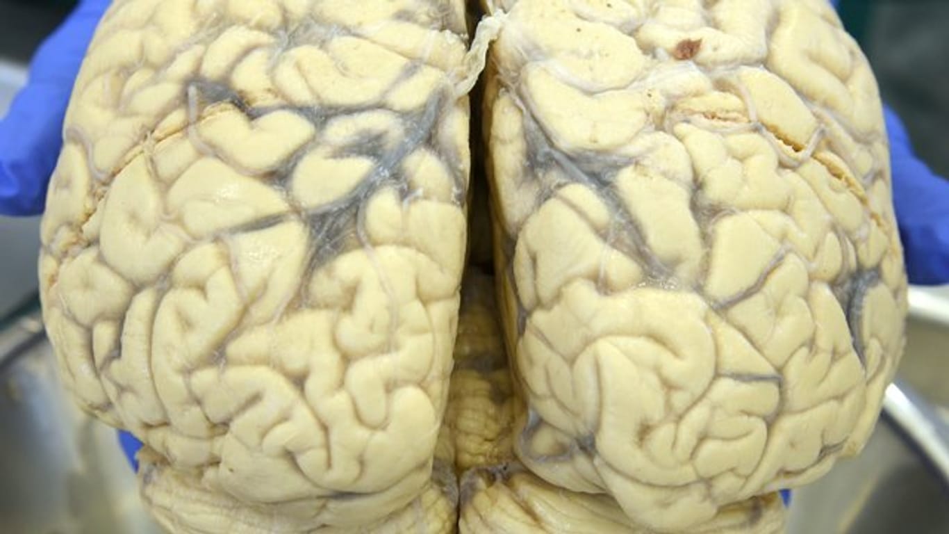 Die graue Substanz besteht hauptsächlich aus Nervenzellen, die weiße Substanz aus Nervenbahnen.