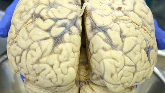 Die graue Substanz besteht hauptsächlich aus Nervenzellen, die weiße Substanz aus Nervenbahnen. Die graue Substanz besteht hauptsächlich aus Nervenzellen, die weiße Substanz aus Nervenbahnen.