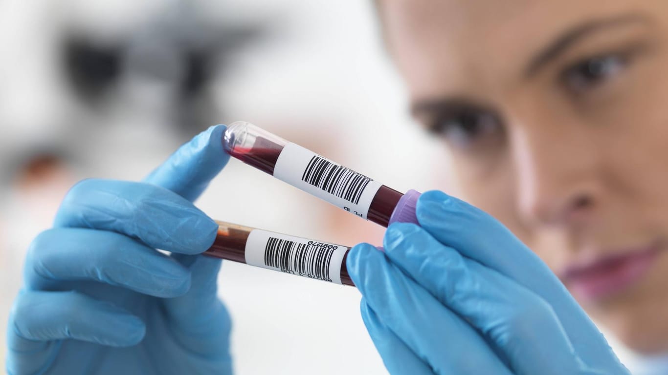 Bluttest: Pränatale Untersuchungen können Aufschluss über mögliche Erkrankungen geben.