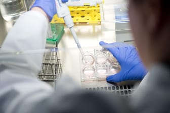Laborarbeit: Im Uniklinikum Würzburg wird eine neue Immuntherapie gegen Krebs angewendet – nun konnte ein erster Erfolg vermeldet werden.