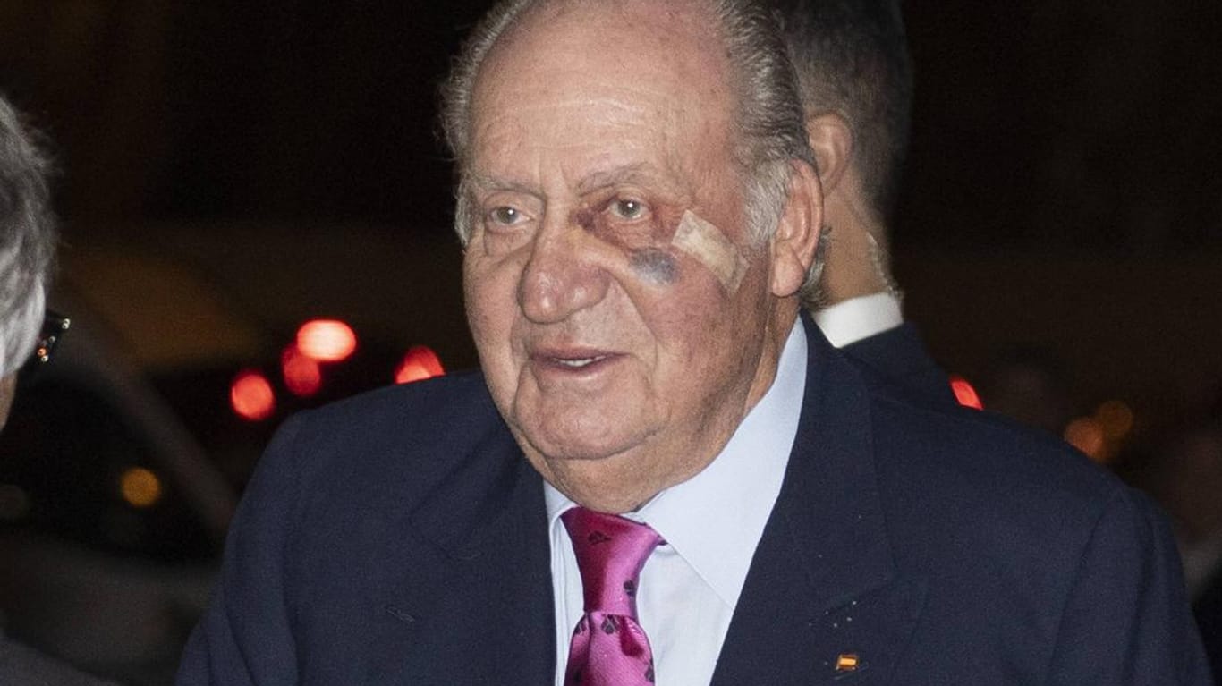 König Juan Carlos: Am Freitag zeigte er sich bei einer Veranstaltung mit Verletzungen im Gesicht.