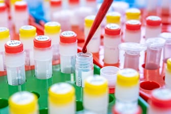 Bluttest: Für eine wissenschaftlich strittige Veröffentlichung hat sich die Uniklinik Heidelberg entschuldigt.