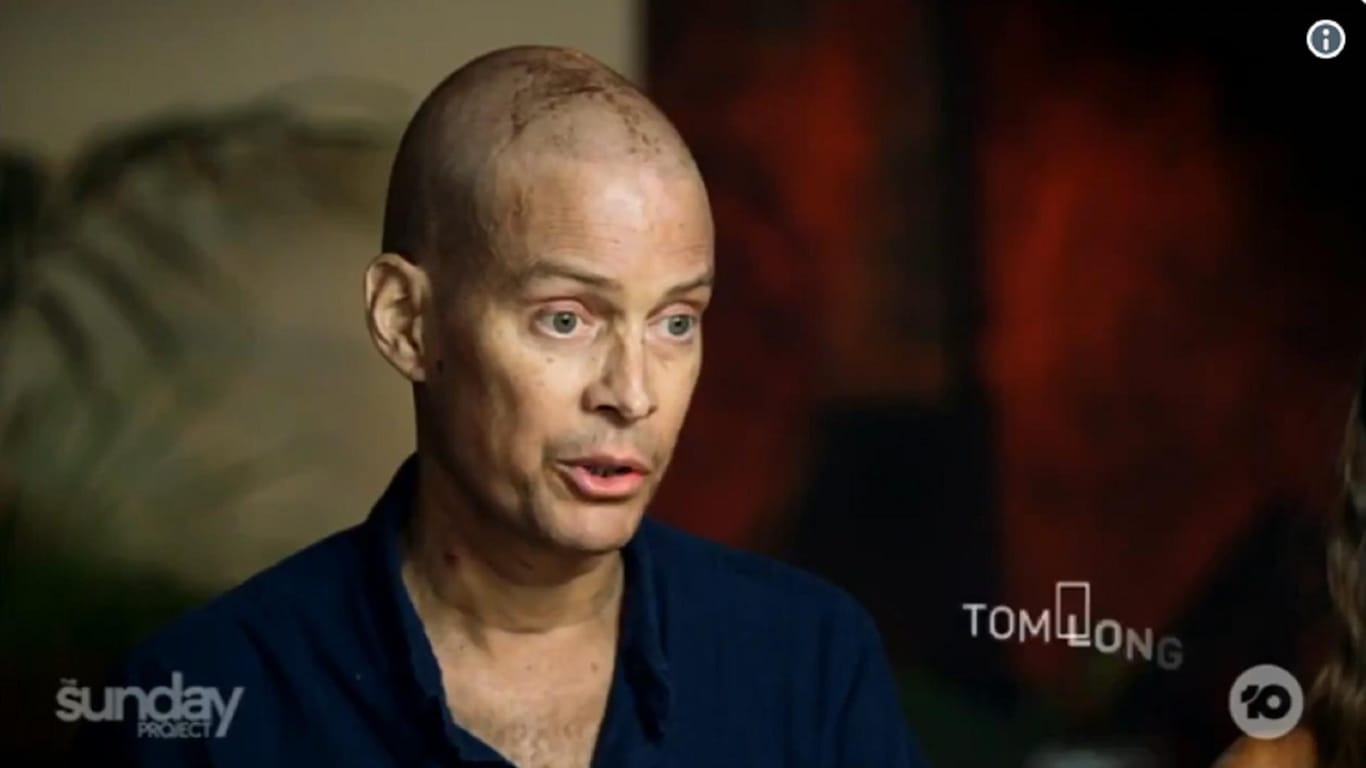 Tom Long: Der Schauspieler ist an Krebs erkrankt.
