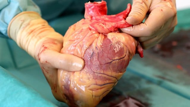 Ein Transplantationsmediziner hält in der Pathologie des Südstadt-Klinikums ein Herz in den Händen. Ein Transplantationsmediziner hält in der Pathologie des Südstadt-Klinikums ein Herz in den Händen.