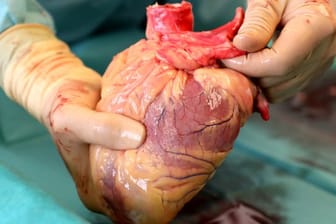 Ein Transplantationsmediziner hält in der Pathologie des Südstadt-Klinikums ein Herz in den Händen.