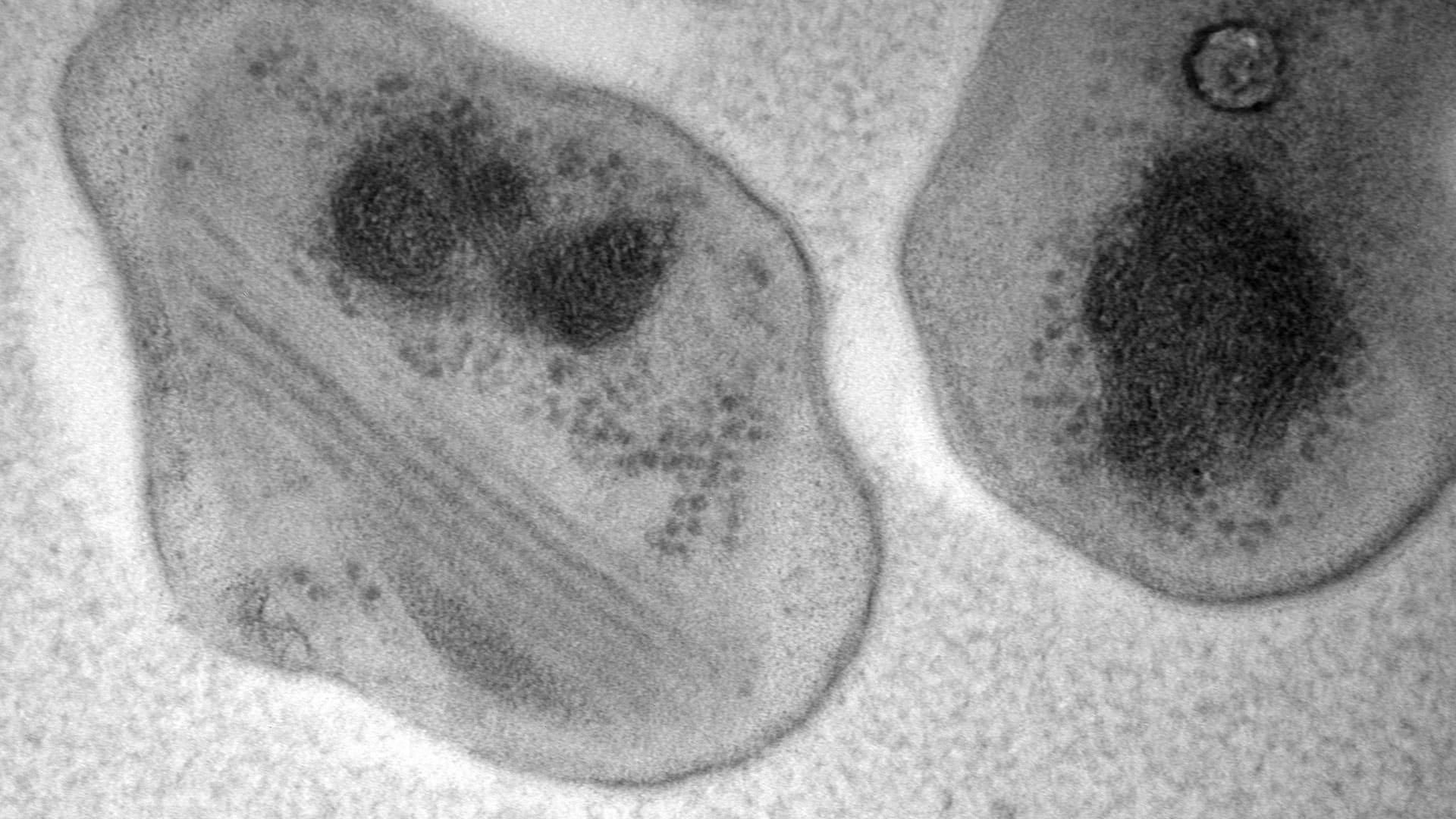 Das Bakterium "Methylocapsa gorgona": Das Bakterium ernährt sich von Methan, Stickstoff, Sauerstoff, Kohlenmonoxid und Wasserstoff. Das Bakterium "Methylocapsa gorgona": Das Bakterium ernährt sich von Methan, Stickstoff, Sauerstoff, Kohlenmonoxid und Wasserstoff.