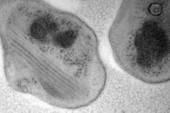 Das Bakterium "Methylocapsa gorgona": Das Bakterium ernährt sich von Methan, Stickstoff, Sauerstoff, Kohlenmonoxid und Wasserstoff.