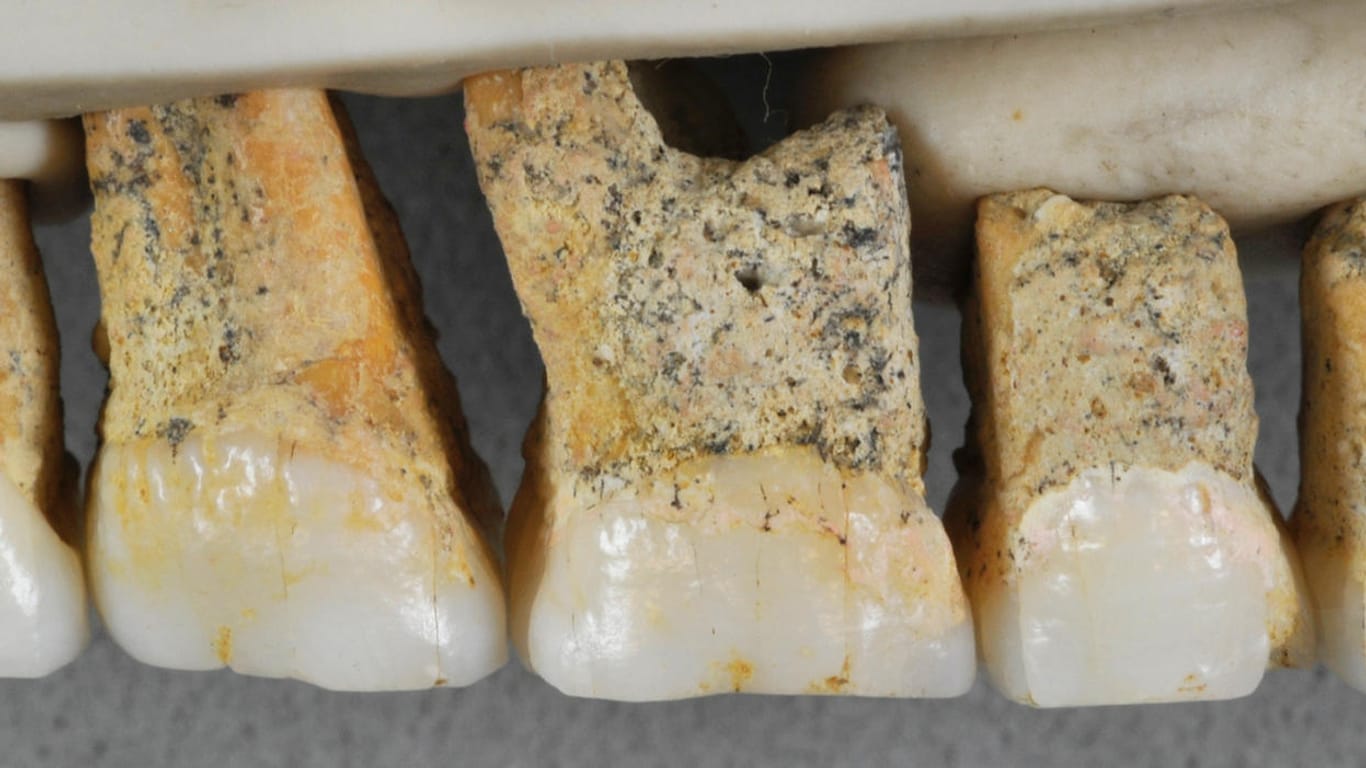 Zähne eines Luzon-Menschen: Die Funde vergleichen Wissenschaftler mit Zähnen anderer Menschenarten.