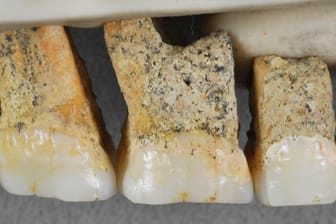 Zähne eines Luzon-Menschen: Die Funde vergleichen Wissenschaftler mit Zähnen anderer Menschenarten.