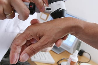 Ein Hautarzt untersucht die Haut einer Patientin: Jedes Jahr stellen Dermatologen rund 21.000 neue Hautkrebserkrankungen fest. (Symbolbild)