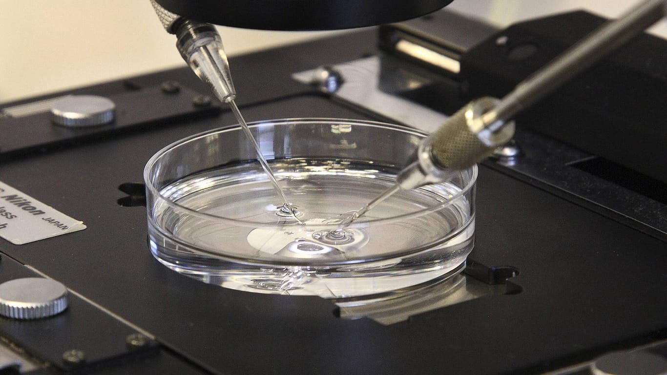 Künstliche Befruchtung: Ein DNA-Test überführte nun einen Arzt in den Niederlanden.
