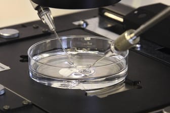 Künstliche Befruchtung: Ein DNA-Test überführte nun einen Arzt in den Niederlanden.
