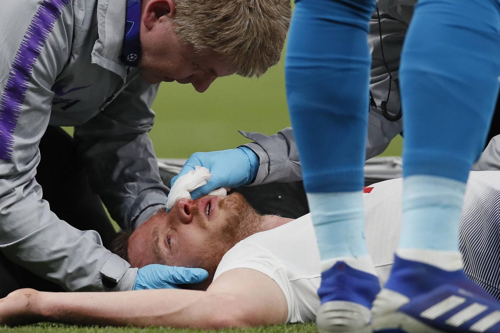 Jan Vertonghen liegt benommen auf dem Boden.