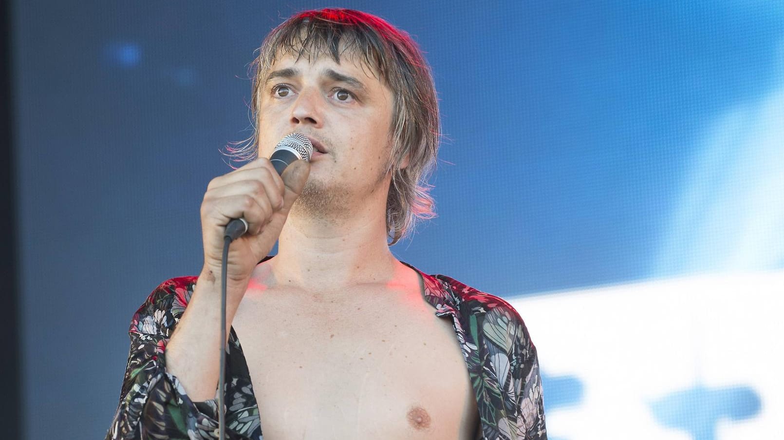 Pete Doherty: Der Sänger wurde von einem Igel gebissen.