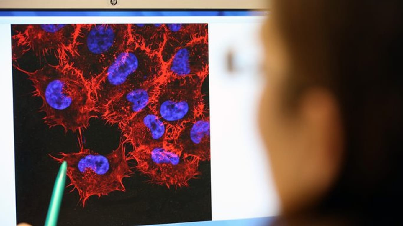 Im Labor des Instituts für Experimentelle Gentherapie und Tumorforschung (IEGT) der Universitätsmedizin Rostock schaut eine Doktorandin auf ein Bild von Melanom-Zellen.