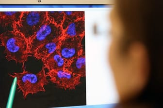 Im Labor des Instituts für Experimentelle Gentherapie und Tumorforschung (IEGT) der Universitätsmedizin Rostock schaut eine Doktorandin auf ein Bild von Melanom-Zellen.