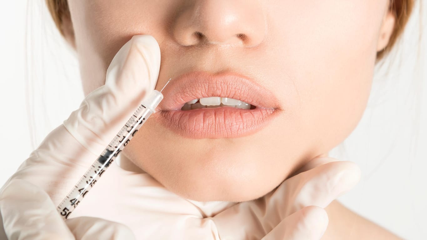 Frau lässt sich die Lippen aufspritzen: Lippenkorrekturen liegen derzeit auf Platz zwei bei den häufigsten Eingriffen.