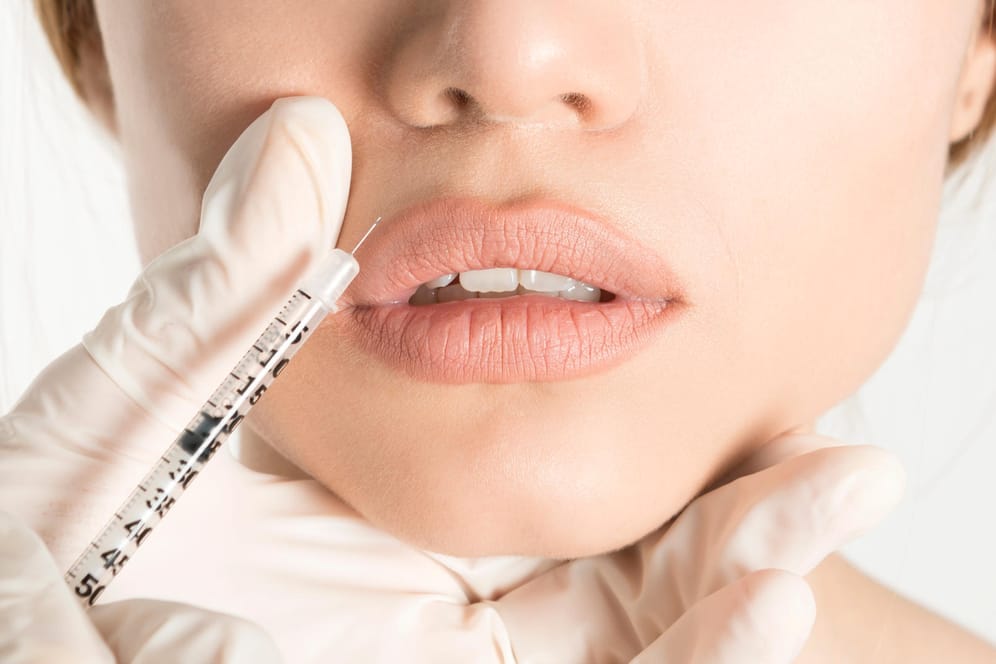 Frau lässt sich die Lippen aufspritzen: Lippenkorrekturen liegen derzeit auf Platz zwei bei den häufigsten Eingriffen.