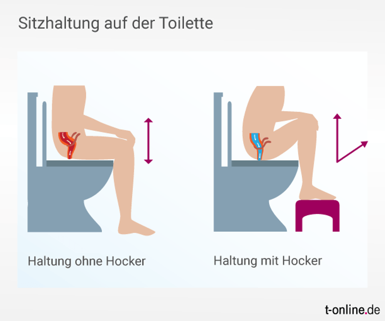 Symbolische Darstellung eines Menschen auf der Toilette: Stehen die Füße höher, kann sich der Darm besser entleeren.