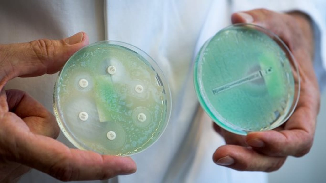 Petrischalen mit Antibiotikatestplatten mit Pseudomonas aeruginosa (grünes schleimiges Wachstum).