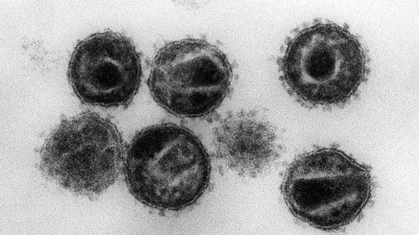 Das HI-Virus befällt und zerstört bestimmte Zellen der Immunabwehr und macht Infizierte anfällig für Krankheiten.
