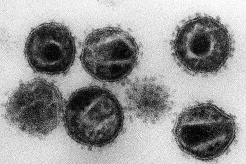 Das HI-Virus befällt und zerstört bestimmte Zellen der Immunabwehr und macht Infizierte anfällig für Krankheiten.