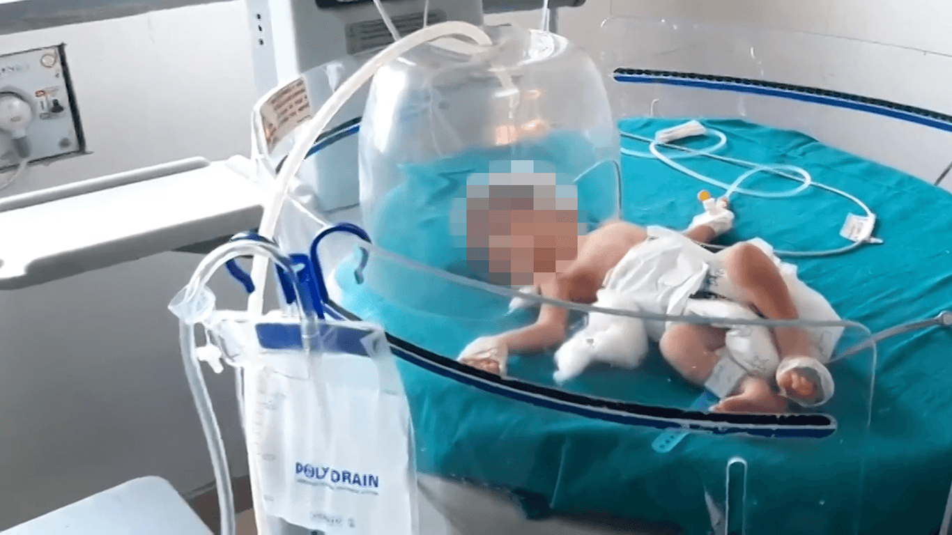 Baby auf der Intensivstation: Das kleine Mädchen hat Glück gehabt, sagten die Ärzte.