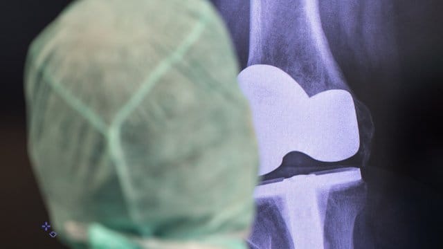Bei anhaltenden Schmerzen am künstlichen Knie- oder Hüftgelenk hat, sollte umgehend zum Arzt gehen. Bei anhaltenden Schmerzen am künstlichen Knie- oder Hüftgelenk hat, sollte umgehend zum Arzt gehen.