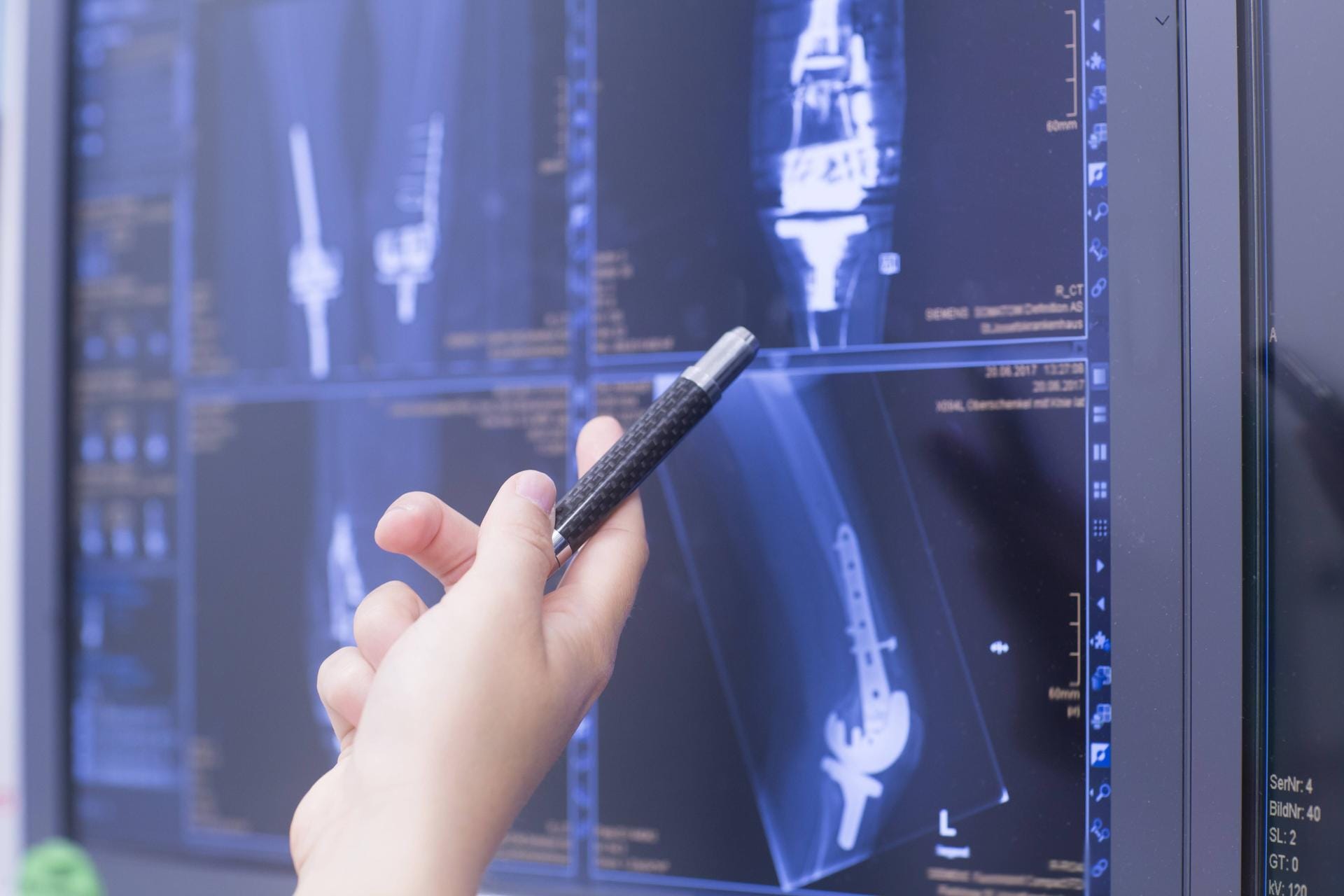 Radiologen können laut einem Bericht durch Pauschalen für Kontrastmittel viel Geld dazuverdienen. Radiologen können laut einem Bericht durch Pauschalen für Kontrastmittel viel Geld dazuverdienen.